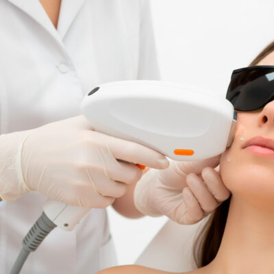 Depilación Mejillas