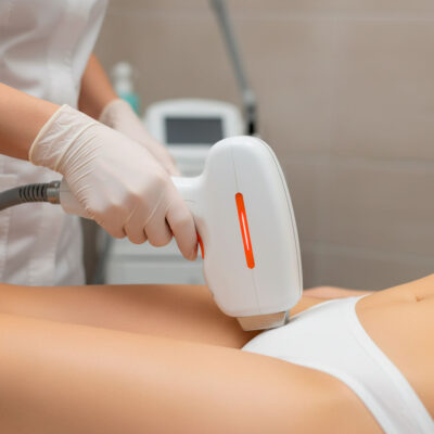 Depilación Rebaje corto