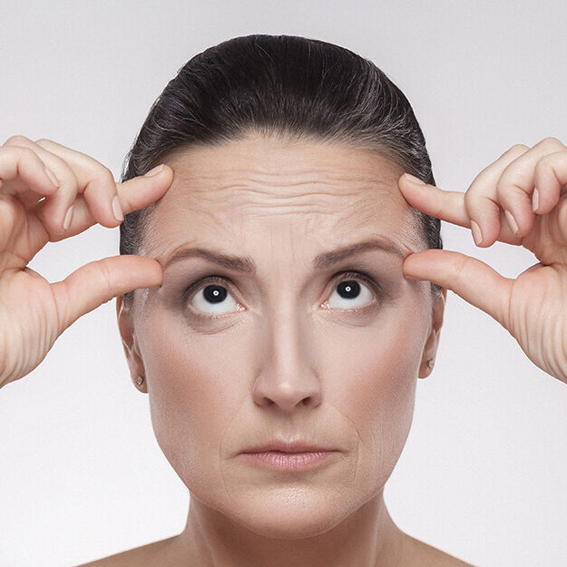 Toxina Botulínica Tercio superior