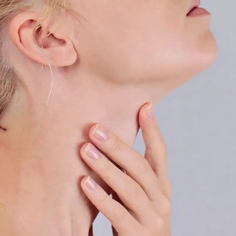 Hilos PDO Zona del cuello